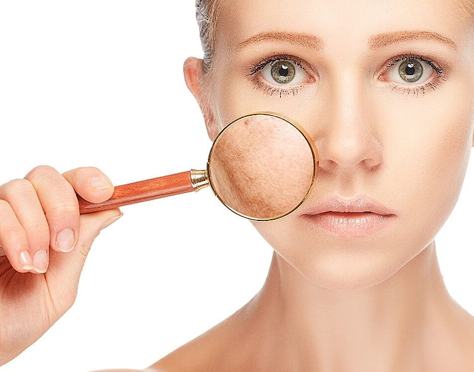 Woman holding a magnifying glass over her cheek, showing skin pigmentation