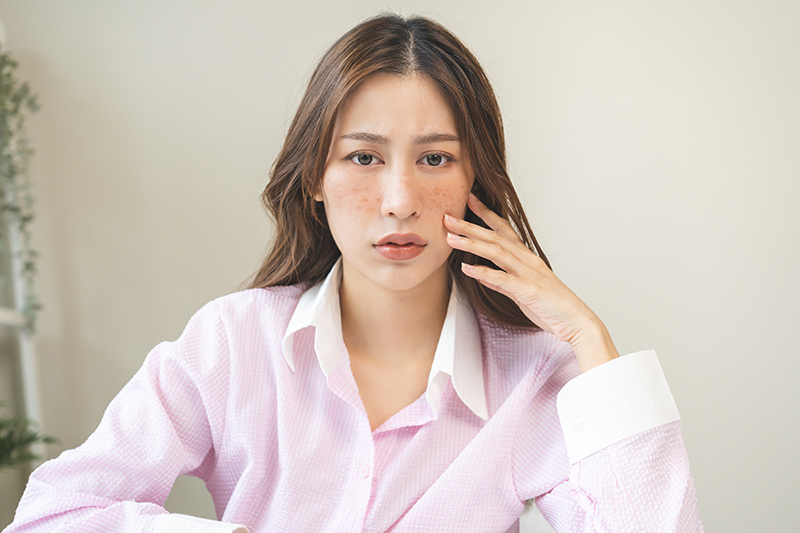 Common Skin Pigmentation Disorders That Specialists Can Treat
