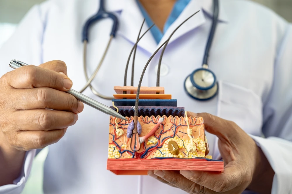 A dermatologist holding an anatomical model of the skin