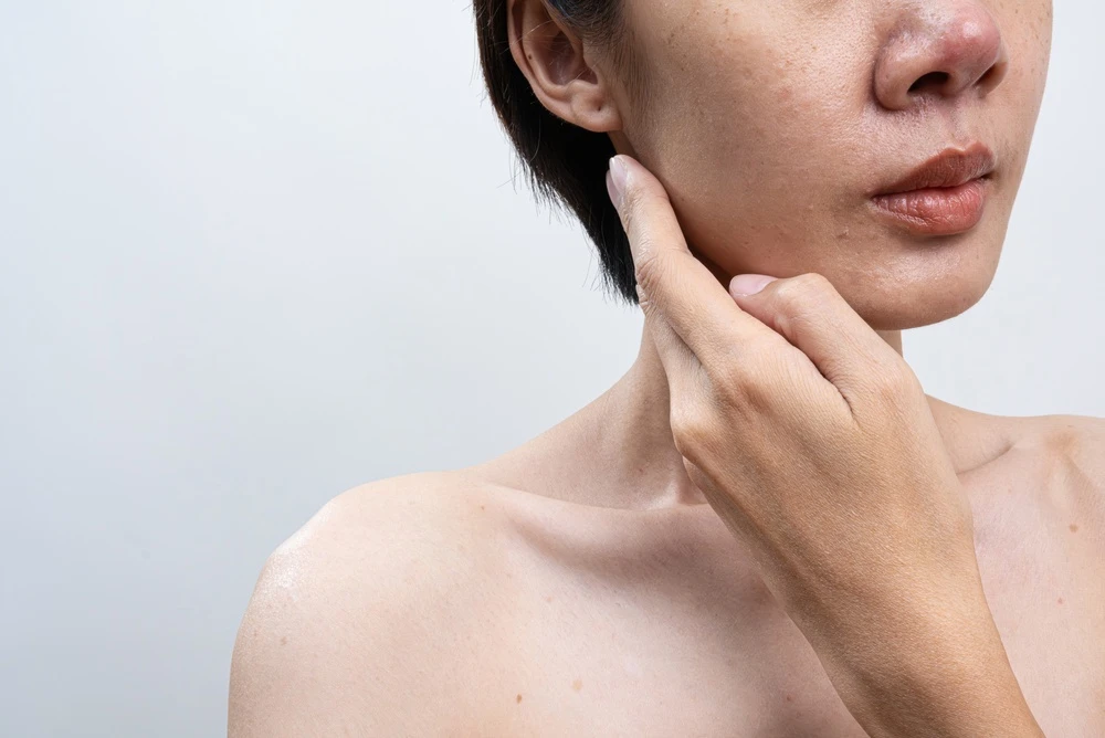 When Should You Visit a Dermatology Clinic in Singapore?