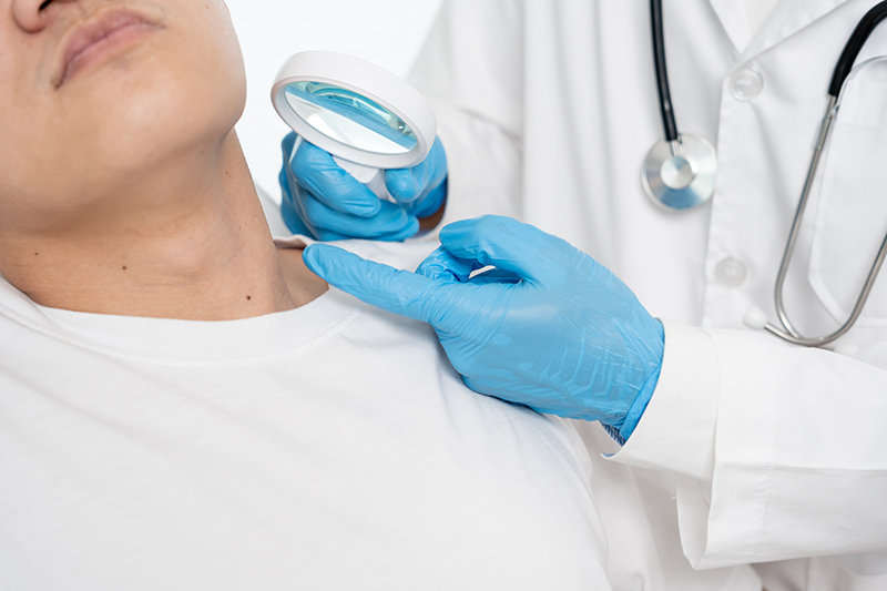 A dermatologist examining a patient's skin for acne scars