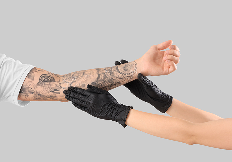 Laser Tattoo Removal: Understanding Results and Expectations