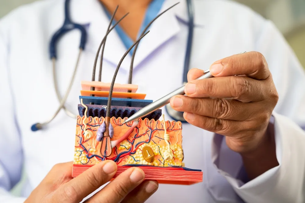 Dermatologist holding an anatomical model of the skin