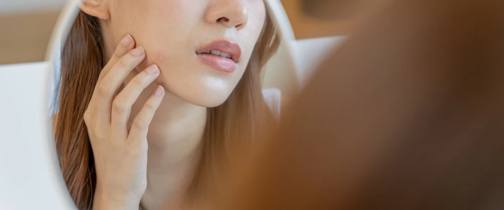 When Should You Visit a Dermatology Clinic in Singapore?
